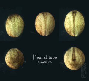 Neural tube closure