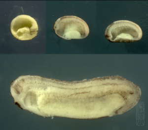 Neural tube closure (section)