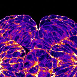 Closing neural tube